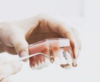 Especialização em Prótese Dentária Unit